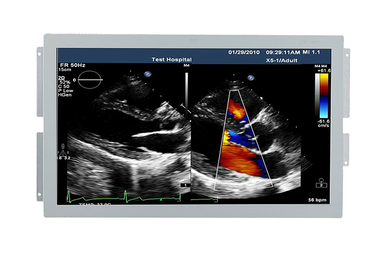 �ڲ�tengbo9885_��ҳ(��ӭ��)